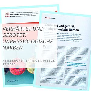 Narben | Wundheilung| Dr. Schuhmann | Springer Pflege