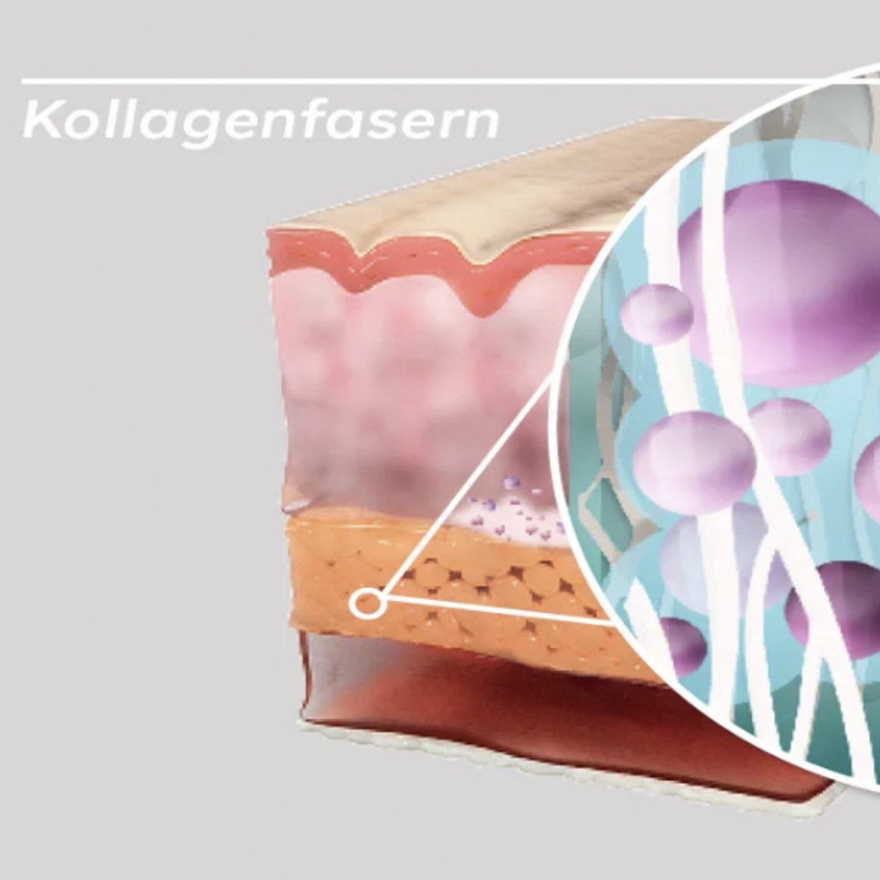 Sculptra Behandlung