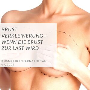 Brustverkleinerung | Plastische Chirurgie Düsseldorf, Bochum | Dr. Schuhmann
