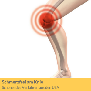 Schonendes Verfahren aus den USA nimmt Schmerzen im Knie