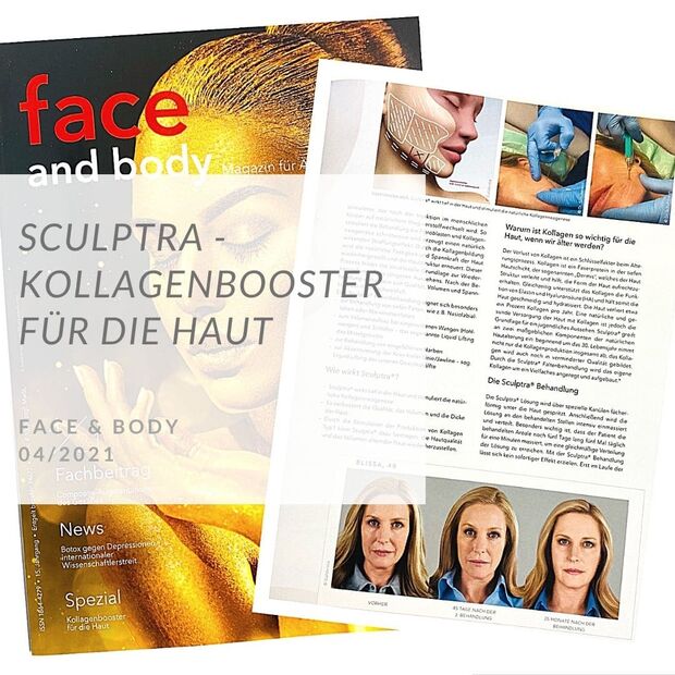 Sculptra | Artikel Face & Body | Autor Dr. Karl Schuhmann