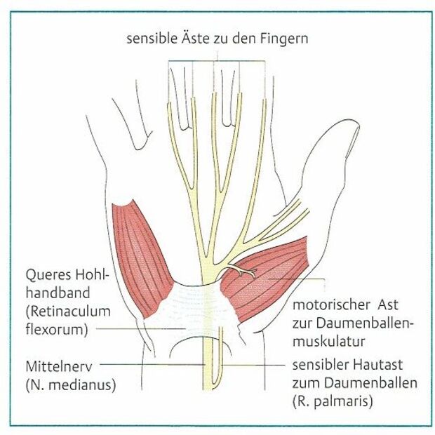 Karpaltunnelsyndrom | Nervenengpass | Dr. Karl Schuhmann