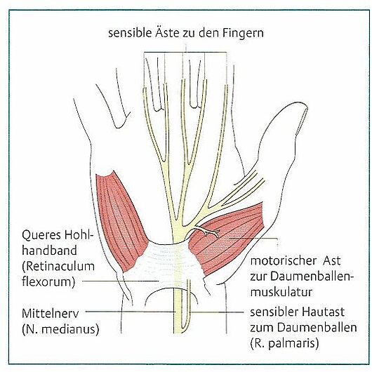 Karpaltunnelsyndrom | Nervenengpass | Dr. Karl Schuhmann