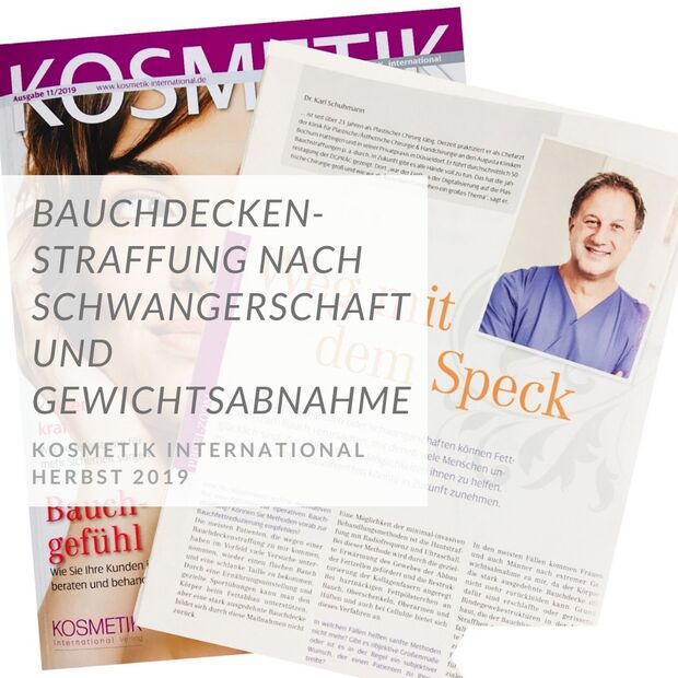 Bauchdeckenstraffung | nach Schwangerschaft oder Gewichtsreduktion | Dr. Schuhmann Düsseldorf