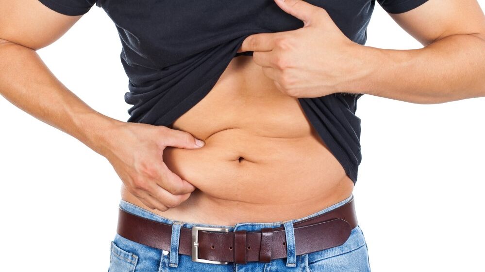 Fettabsaugung | Fett-weg | für Männer Fettabsaugung am Bauch | für den Mann bei Dr. Karl Schuhmann
