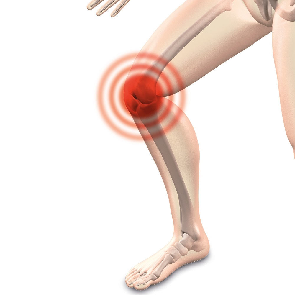 Schmerzen im Knie - Kniedenervation hilt. Kniegelenksdenervation_-_Knieschmerzen__Dr._Karl_Schuhmann.jpg
