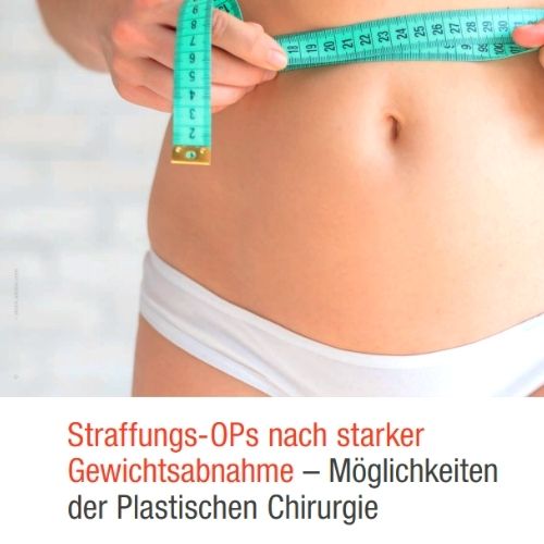 StraffungsOperationen nach starker Gesichtsabnahme